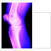 X-Ray of a Knee by Anonymous