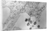 Tumors Budding from Cell Membrane by Anonymous