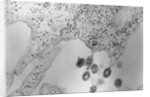Tumors Budding from Cell Membrane by Anonymous
