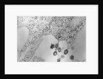 Tumors Budding from Cell Membrane by Anonymous