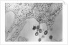 Tumors Budding from Cell Membrane by Anonymous