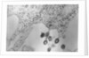Tumors Budding from Cell Membrane by Anonymous