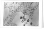 Tumors Budding from Cell Membrane by Anonymous