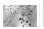 Tumors Budding from Cell Membrane by Anonymous