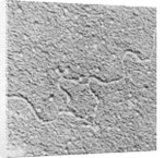 Magnification of Human Genes by Anonymous