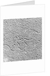 Magnification of Human Genes by Anonymous