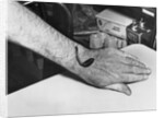 Man Receiving Help from Leech by Anonymous