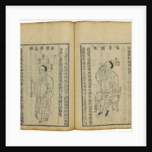 Shen Shi Yao Han (A Precious Book of Ophthalmology), 1644 by Fu Renyu
