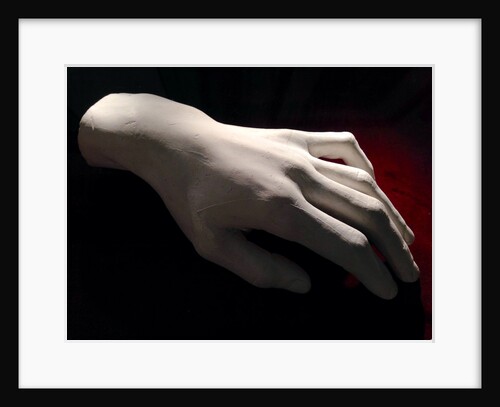 Frédéric Chopins left hand, 1849 by Anonymous