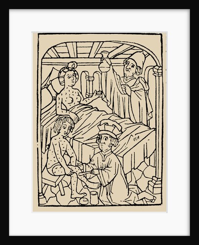 Syphilis treatment: Treatment with ointments (mercury). From: A Malafranczos morbo gallorum preserv by Anonymous