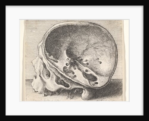 Sectioned skull in profile to left with the left side of the cranium removed, 1651 by Wenceslaus Hollar