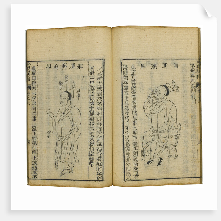 Shen Shi Yao Han (A Precious Book of Ophthalmology), 1644 by Fu Renyu