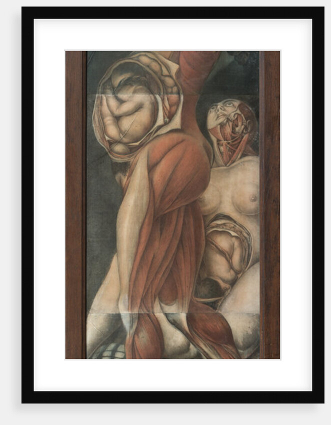 Two pregnant women by Anonymous