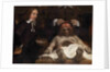 The Anatomy Lesson of Dr. Jan Deijman, 1656 by Rembrandt van Rhijn