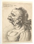 Bust of a woman wearing low-cut dress, with protruding lipd, growth on her forehead, promi…, 1660 by Wenceslaus Hollar