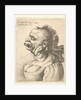 Bust of a woman wearing low-cut dress, with protruding lipd, growth on her forehead, promi…, 1660 by Wenceslaus Hollar