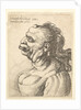 Bust of a woman wearing low-cut dress, with protruding lipd, growth on her forehead, promi…, 1660 by Wenceslaus Hollar