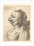 Bust of a woman wearing low-cut dress, with protruding lipd, growth on her forehead, promi…, 1660 by Wenceslaus Hollar