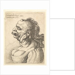 Bust of a woman wearing low-cut dress, with protruding lipd, growth on her forehead, promi…, 1660 by Wenceslaus Hollar