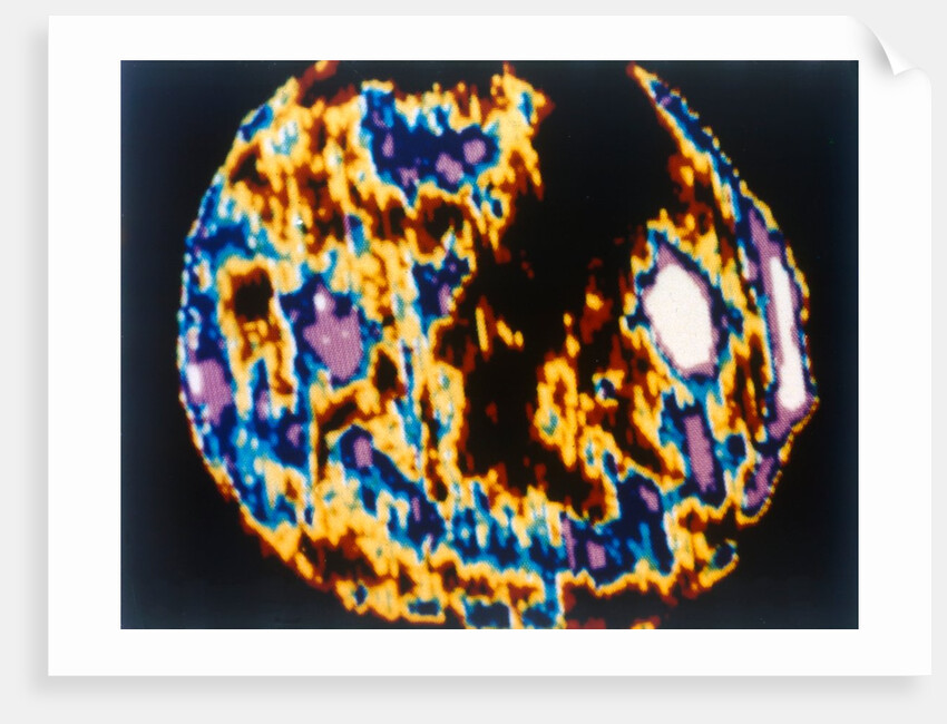 The Sun viewed with the Skylab 3 Apollo Telescope Mount, 1973 by NASA