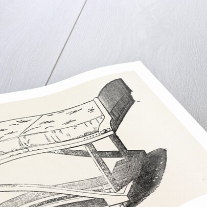 Invalid Chair and Bed by Anonymous