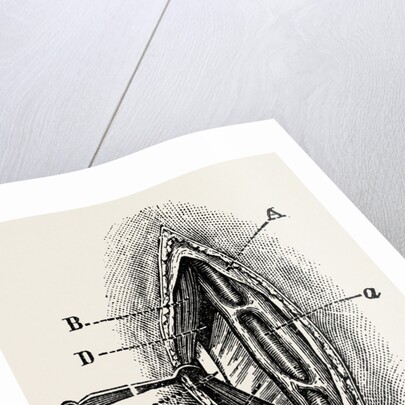 Ligatuite of the right radial by Anonymous