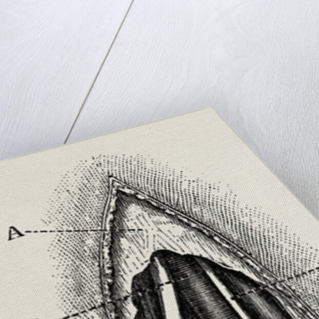 Ligature of the right finger by Anonymous