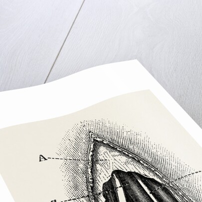 Ligature of the right finger by Anonymous