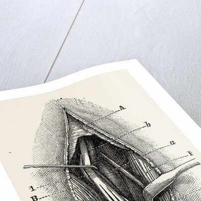 Ligature by Anonymous