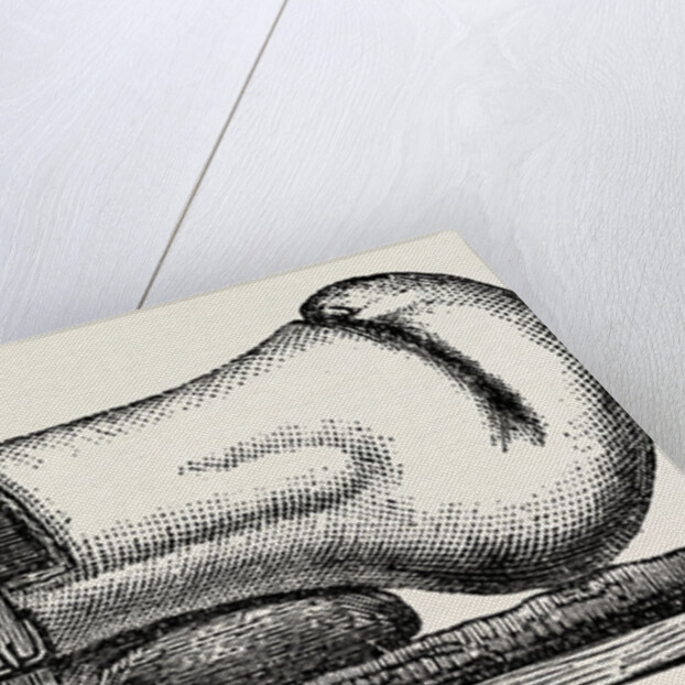 Supporting splint adjusted to the leg by Anonymous