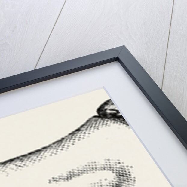 Supporting splint adjusted to the leg by Anonymous