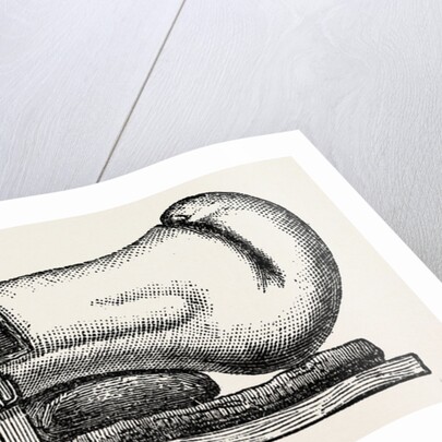 Supporting splint adjusted to the leg by Anonymous