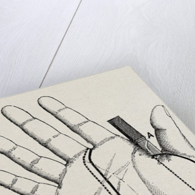 Disartieulation of the thumb by Anonymous