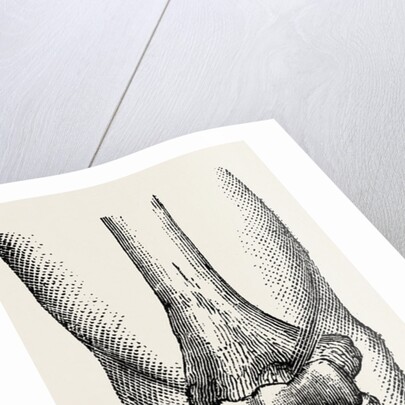 Disarticulation by Anonymous