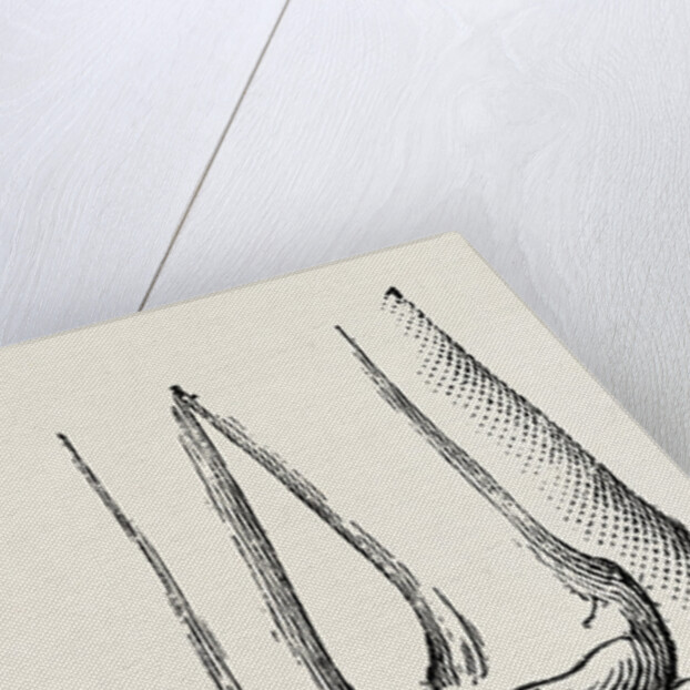 Disarticulation by Anonymous