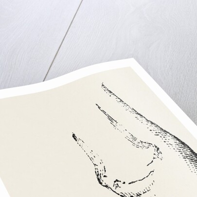Disarticulation by Anonymous