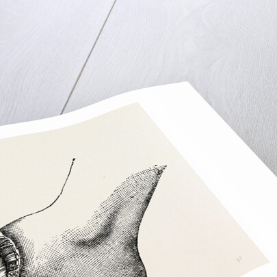 The coup de maitre in lisfrancis amputation by Anonymous