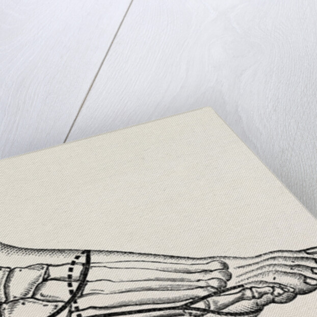 Disarticulation of the little toe by Anonymous