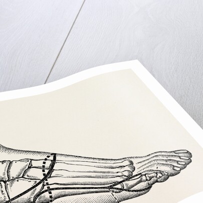 Disarticulation of the little toe by Anonymous