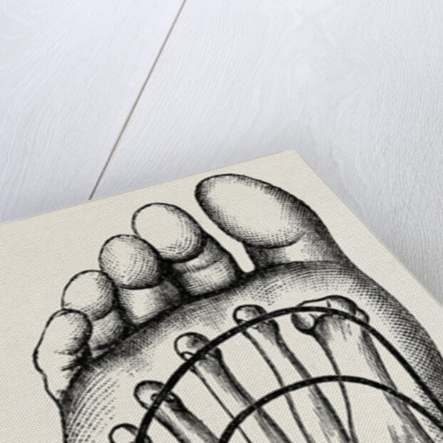 Plantar incisions by Anonymous