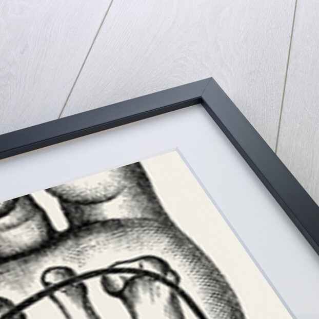 Plantar incisions by Anonymous