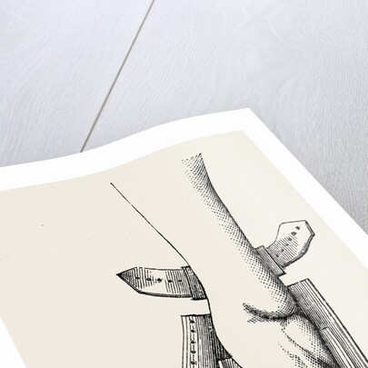 Aspect of limb by Anonymous