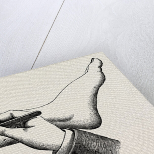 Mode of cutting the flap in the amputation at 44 by Anonymous