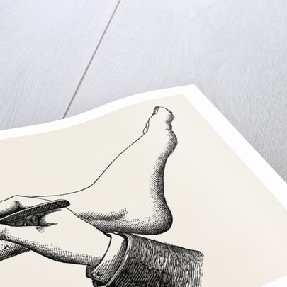 Mode of cutting the flap in the amputation at 44 by Anonymous