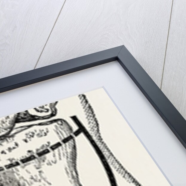 Amputation by Anonymous