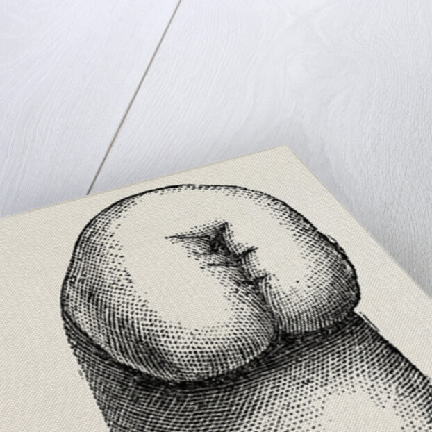 The stump by Anonymous