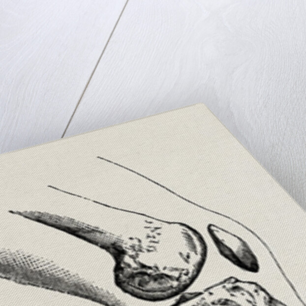 Disarticulation isarticulation by Anonymous