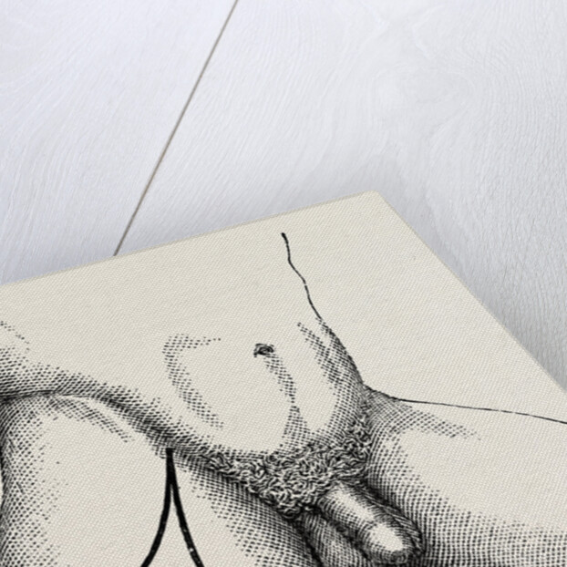 Disarticulation by Anonymous