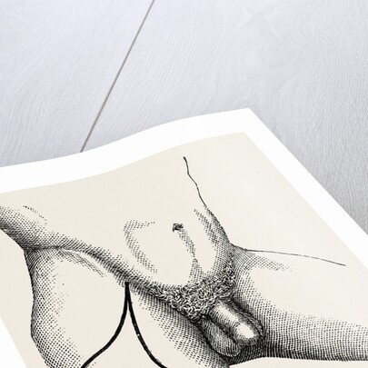 Disarticulation by Anonymous