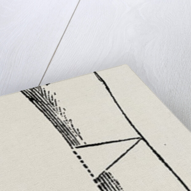 Diagram representing a curved tibia, with a wedge removed by Anonymous